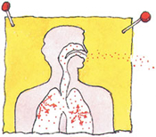 Radon & Lung Cancer